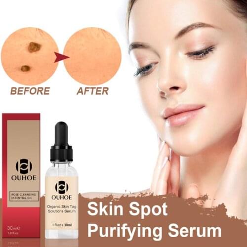 30ml Organic Tags Solutions Serum Face Care Effective Mole Corrector Skin Tag Remover Spot Purifying Cosmetics Skin Care