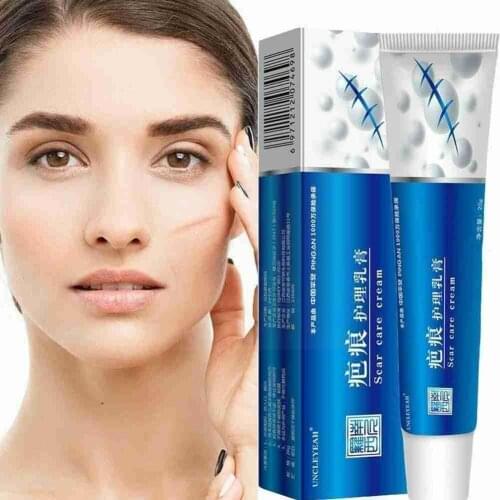 Acne Scar Removal Cream Scar Gel Skin Repair Face Cream Treatment Spots Care Marks Skin Stretch Acne Skin Whitening Acne Ca U0Q7