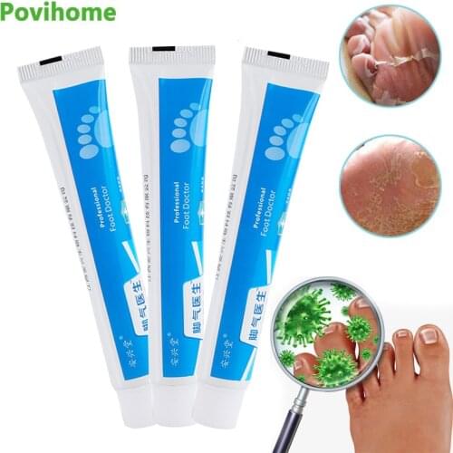 3Pcs Beriberi Antibacterial Ointment Athletes Foot Cream Anti Itching Relieve Feet Sweat Odor Peeling Anti Fungal Infections