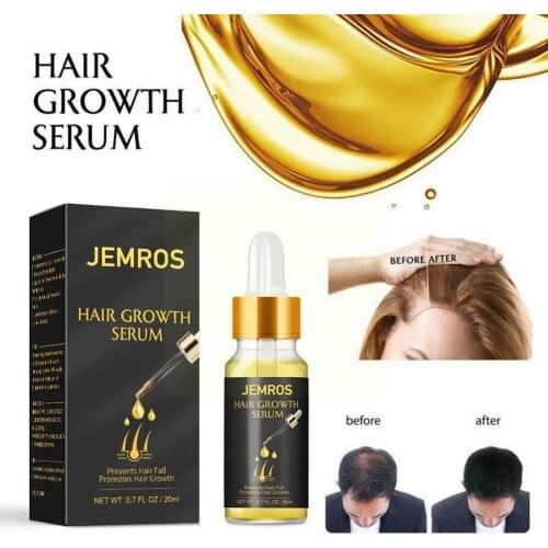 1pc Vegetable Oil Hair Growth Essence Prevent Hair Strengthen Scalp Regeneration Nourish Hair Heal Product Loss Repair Root W3L9
