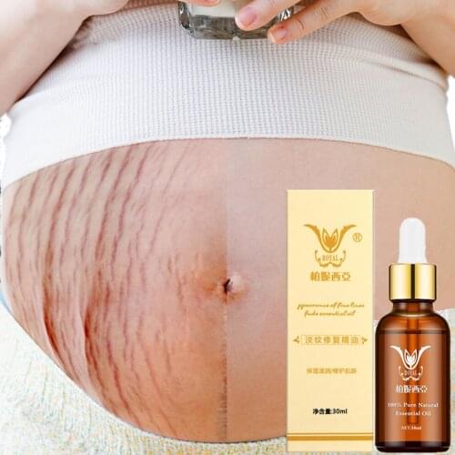 Stretch Marks Removal Essential Oils Pure Natural Stretch Marks Remover Obesity Postpartum Anti-wrinkle Repair Cream Skin Care