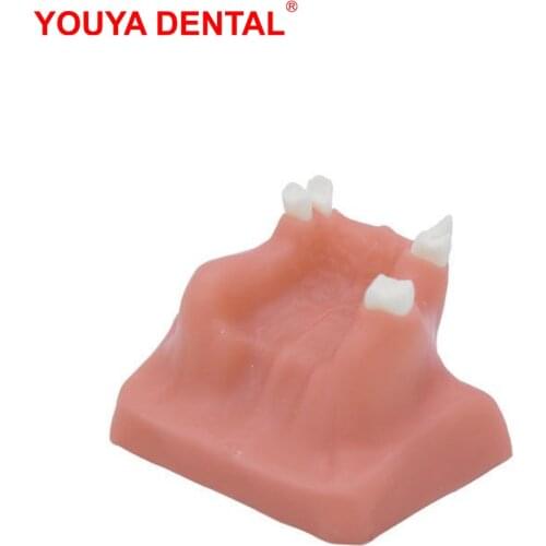 Dental Model Teeth Implant Practice Model Maxillary Sinus Tooth Implant Model For Dentist Student Training Teaching Studying New