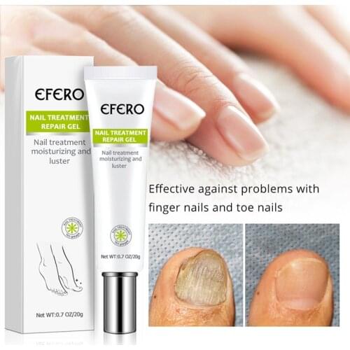 EFERO Foot Gels