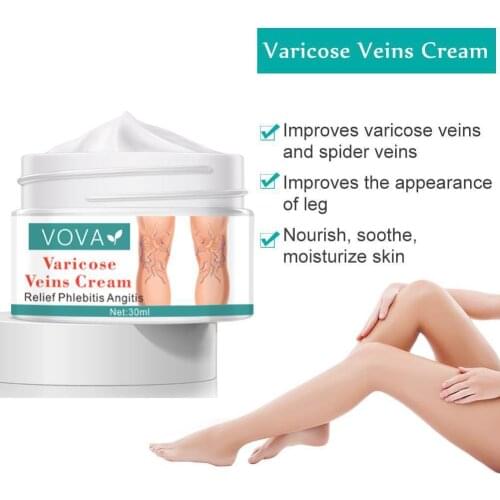Varicose Vein Ointment Improves Leg Nourishment, Soothes And Moisturizes The Skin, Improves Spider Veins