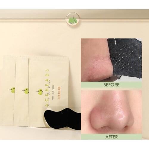 1pcs Nose Blackhead Remover Mask Patch Black Head Removal Masks Tool Acne Treatment Peel Strips Cleasing D5O8