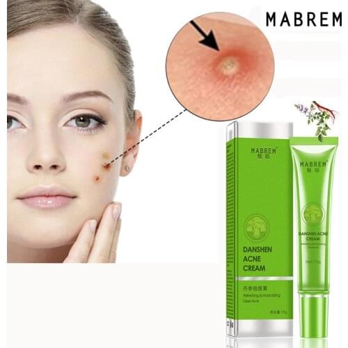 Acne Treatment Face Cream Blackhead Repair Gel Oil Control Shrink Pores Acne removal Creams anti acne face cream Skin Care 15g