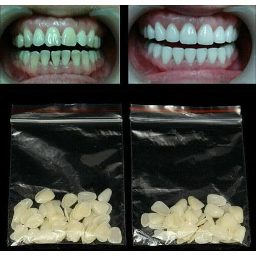 100pcs Beige Temporary Porcelain Dental Material Mixed Temporary Crown Rear Finishing Teeth Dentist Product