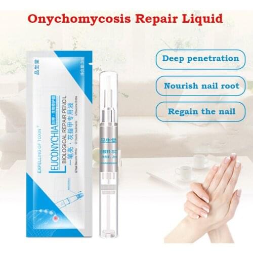 1PC Anti-Fungal Liquid Toenail Fungus Foot Fungus Nail Treatment Nail Oil Pen Nail Cuticle Remover Liquid Nail Skin Care