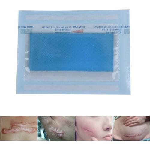3.5*7cm Removal Cesarean Section Hypertrophic Keloid Skin Scars Therapy Treatment Scar Away Patch Silicone Gel Sheet Wound Marks