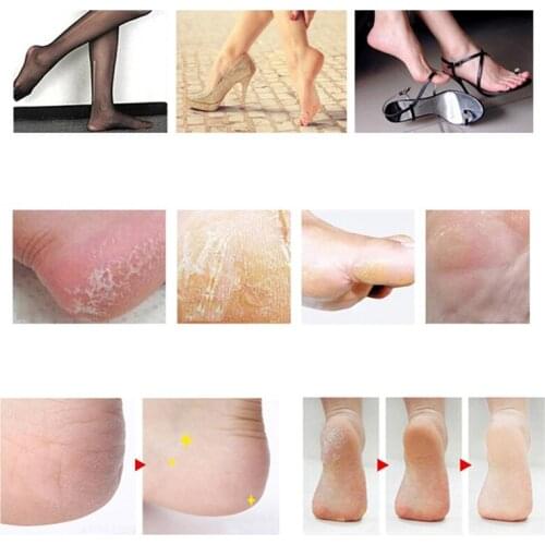 10PCS Foot File Set Dead Hard Skin Callus Remover Scraper Pedicure Rasp Tools Portable Plastic + Stainless Steel