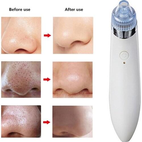 Electric Mini Handheld Dead Skin Acne Vacuum Suction Blackhead Removal Face Lifting Skin Tightening Rejuvenation Beauty Machine