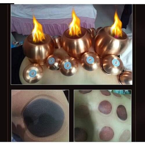 6cm*6.5cm Two times heating Mongolian Red Copper Fire Cupping Jars Therapy Body Cupping Massage Medical Vacuum Stress