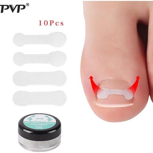 10pcs Ingrown Toenail Correction Tool Ingrown Toe Nail Treatment Elastic Patch Sticker Straightening Clip Brace Pedicure Tool