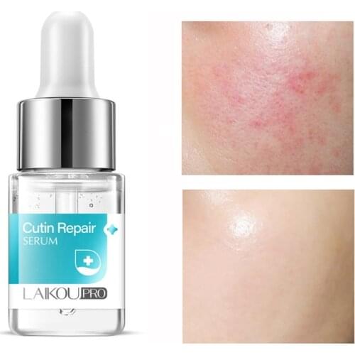 12ml Cutin Repair Face Serum Anti Allergic Shrink Pores Whitening Moisturizing Brightening Nourishing Facial Skin Care