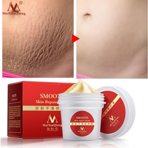 35g Smooth Removes Maternal Skin Repair Body Cream Removes Postpartum Scar Care Gentle Moisturizing Skin Stretch Mark Skin Cream