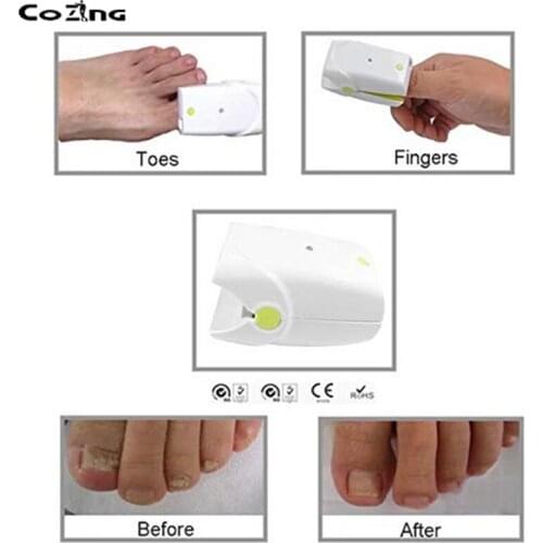 Lllt Semiconductor Laser Therapy Device For Nail Fungus Remove Anti Fungus Treatment No Pain Rechargeable Cold Laser Soft Laser