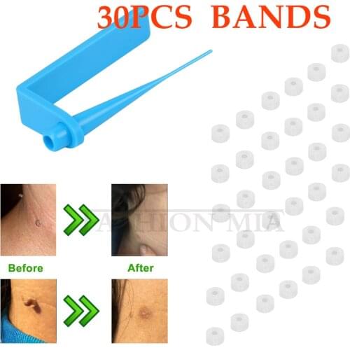 Skin tag remover Rubber bands for micro Skin tag remover wart Remove Acne Pimple Blemish Treatments Face Skin Care Beauty Tools