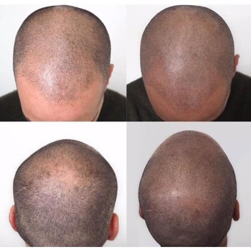 PM Brand Hair Scalp Micropigmentation Pigment Powder Strokes Permanent Makeup Ink
