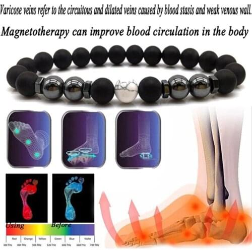 Magnet Anklet Colorful Stone eight Loss Magnetic Therapy Bracelet Weight Loss Product Slimming Health Care jewelry