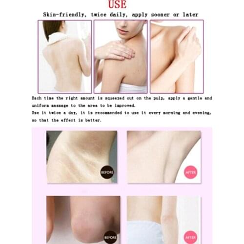 Whitening Body Cream Dark Skin Armpit Knee Thigh Skin Elbow Lightening For Bikini Underarm Thigh Cream
