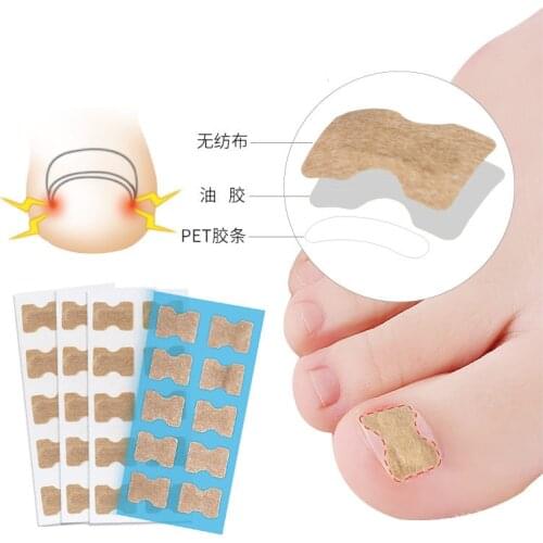 10PCS Ingrown Toenail Correction Stickers Glue Free Ingrown Patch Finger Incorporated Orthodontic Toe Thumb Patch Sticker