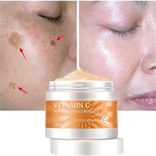Vitamin C Whitening Face Cream Remove Dark Spots Melanin Repair Fade Freckles Facial Cream Anti Aging Brighten Tone Skin Care