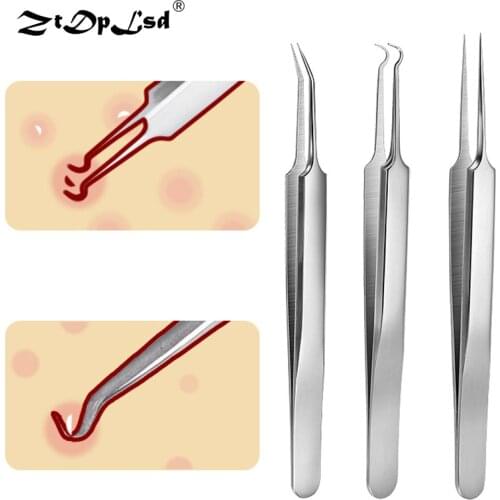 ZtDpLsd 1Pcs Professional Stainless Steel Blackhead Acne Pimple Blemish Extractor Remover Clip Needle Tweezers Tools