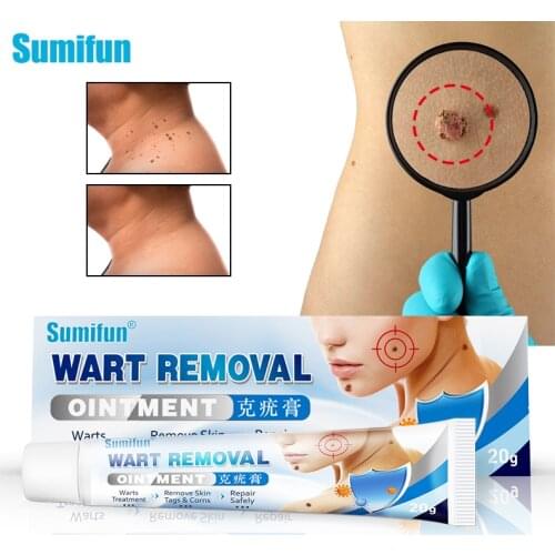 Sumifun 20g Wart Cream Skin Tag Remover Antibacterial Cream Micro Ointment Mole Wart Body Face Care Herbal Extract Ointment