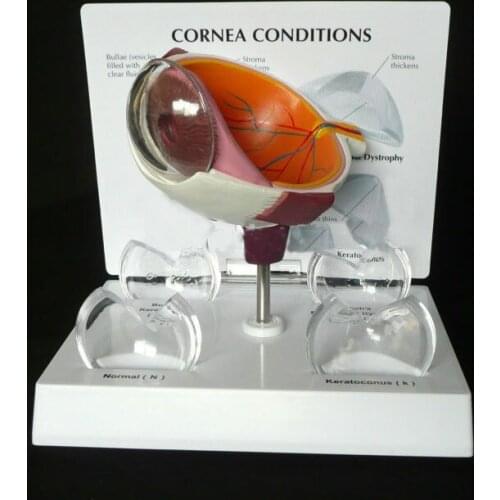 Human Anatomicals Cornea Eye Cross Section Anatomical Model in trauma anatomy skeleton anatomical medical training manikins