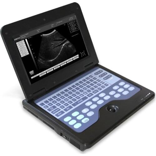 Portable Ultrasound System laptop ultrasound CE approved ultrasound scanner