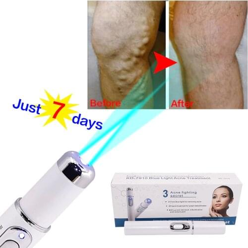 Blue Light Therapy Pen for Varicose Veins Therapy Wrinkle Acne Laser Pen Pen for Varicose Veins Health Care Beauty Products