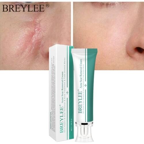 Removal Scars Cream Face Pimples Scar Stretch Marks Removal Acne Treatment Whitening Moisturizing Face Cream Skin Care