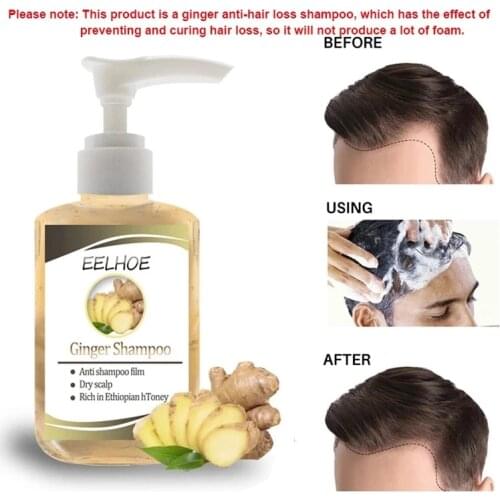 Ginseng Anti-Hair Loss Shampoo Powerful Treatment Essence Herbs Ginger Cooler Hair Growth Lotions for Men Women