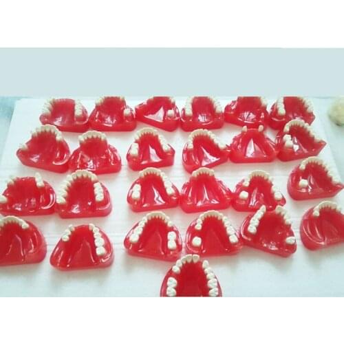 Teeth missing with silicon rubber model partially edentulous teeth model