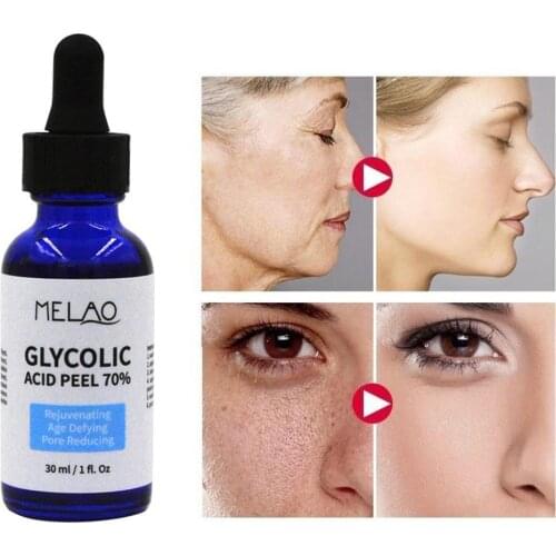 30ml Glycolic Acid Peel Repair Solution Shrink Pores And Balance Nourishing Light Skin Water Improve Acne Skin Oil Color P6D7