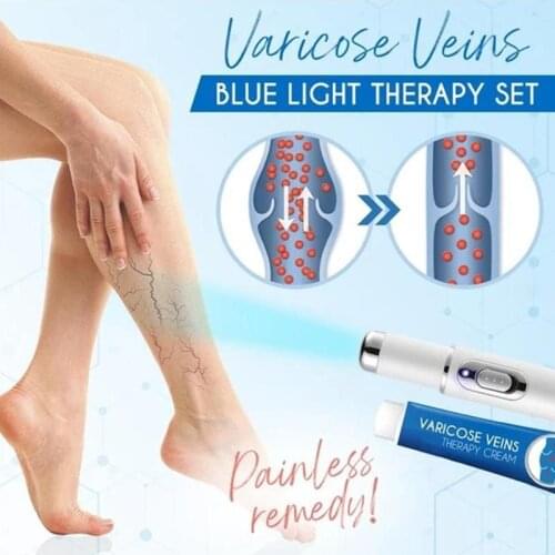 Medical Blue Light Therapy Pen Varicose Veins Treatment Cream Vasculitis Phlebitis Spider Veins Pain Varicosity Ointment
