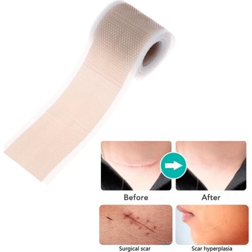 1Roll Silicone Gel Efficient Beauty Scar Removal Silicone Gel Self-Adhesive Silicone Gel Tape Patch For Acne Burn Scar Reduce