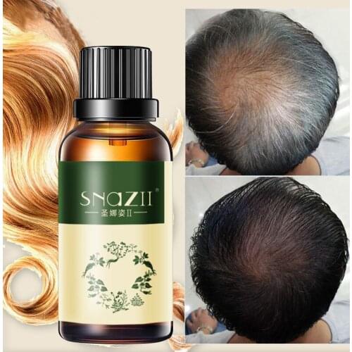 Hair shampoo oil the best effect for hair growth and hair loss prevent premature thinning of hair for men and women