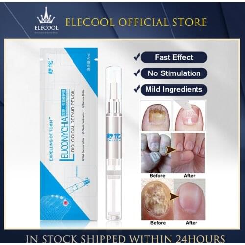 Nail Repair Solution Hand And Foot Women Men Care Repair Of Thick Soft With Polish Liquid Skin Care TSLM1