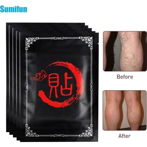 8/16/24pcs Varicose Veins Plaster Vasculitis Phlebitis Spider Leg Skin Care Treatment Herb Medical Patch Angiitis Removal Patch