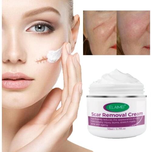 Scar Removal Cream Scar Cream for Acne Marks, Burns, Stretch Marks, Surgical Scars Promote New Skin Growth Scars Treatment