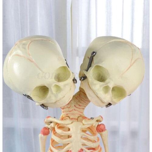 37cm Human Double Head Baby Skull Skeleton Anatomy Brain Display Study Teaching Anatomical Model Drop Shipping