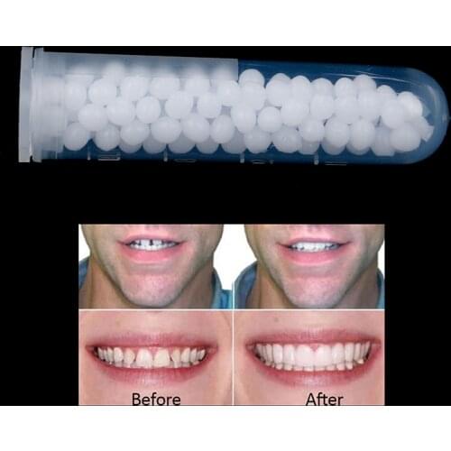 1PCS Teeth Whitening 10g Halloween Solid Glue Teeth And Gaps False Teeth Denture Adhesive Tooth Beauty Tool Tooth Repair