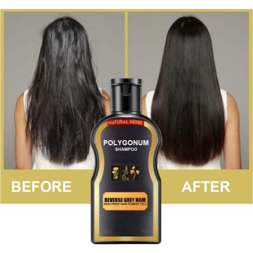 30ml Polygonum Multiflorum Shampoo Natural Black Hair Care Shampoo Moisturizing Anti-hair Loss Solid Hair Conditioner TSLM1