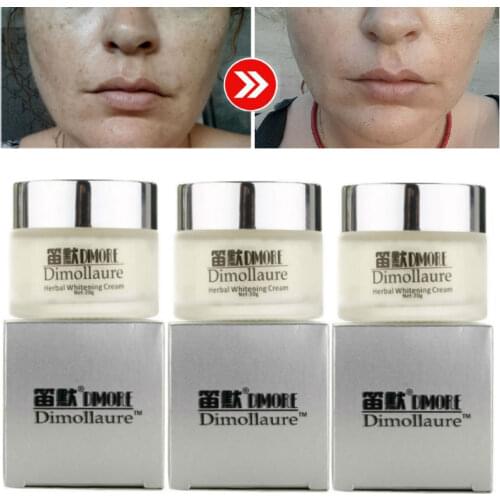 Dimollaure herbal Whitening Freckle cream Removal melasma pigment Melanin Pregnant acne scar brown spots Retinol face cream