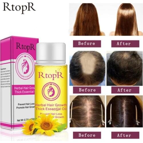 RtopR 20ml Hair Growth Liquid Nourishing Care Serum Essence Growth Promote Hair Growth Prevention Hair Loss Essential Oil