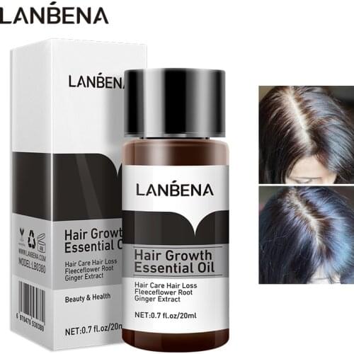 LANBENA Fast Powerful Hair Growth Essential Oil Liquid Treatment Essence Preventing Hair Loss Hair Care Products Andrea 20ml