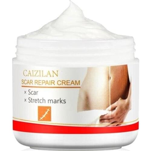 30ml Kernel Stretch Marks Remover Skin Smoothing Cream Anti Winkle Skin Firming Treatment Repair Eliminate Pregnancy Scars Cream