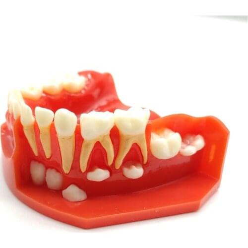 Dental Pediatric development Model