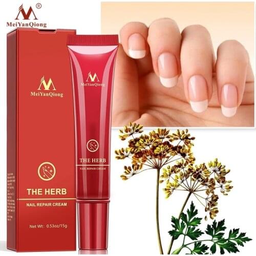 MeiYanQiong 1Pcs Herbal Anti Fungal Nail Treatment Cream Toe Nail Fungus Treatment Onychomycosis Paronychia Toe Nail Infection